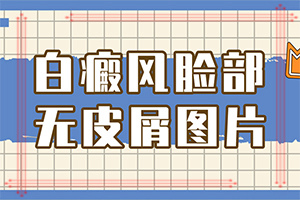 脖子上有白色斑塊是什么原因？白癜風(fēng)誘發(fā)原因做什么檢查-得白癜風(fēng)的概率